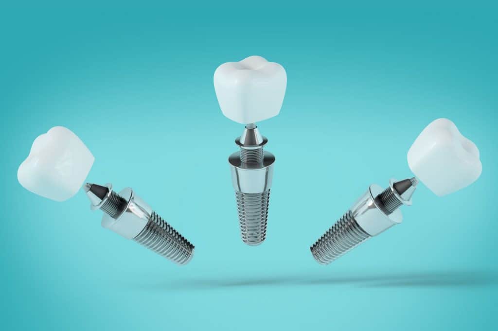 Η χρήση αυτόλογων αυξητικών παραγόντων στην Οδοντιατρική