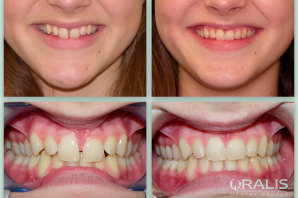 Ορθοδοντική Παίδων & Εφήβων