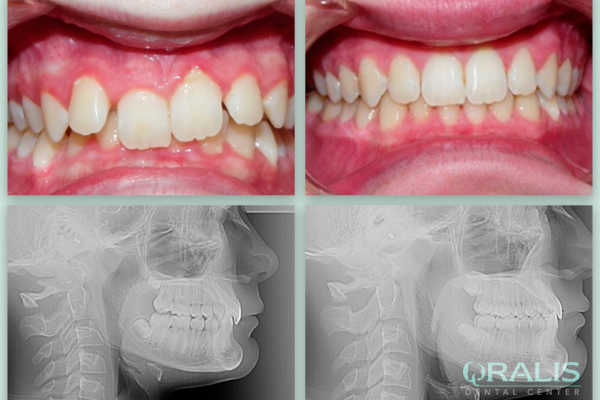 Ορθοδοντική Παίδων & Εφήβων