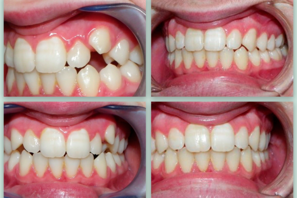 Ορθοδοντική Παίδων & Εφήβων