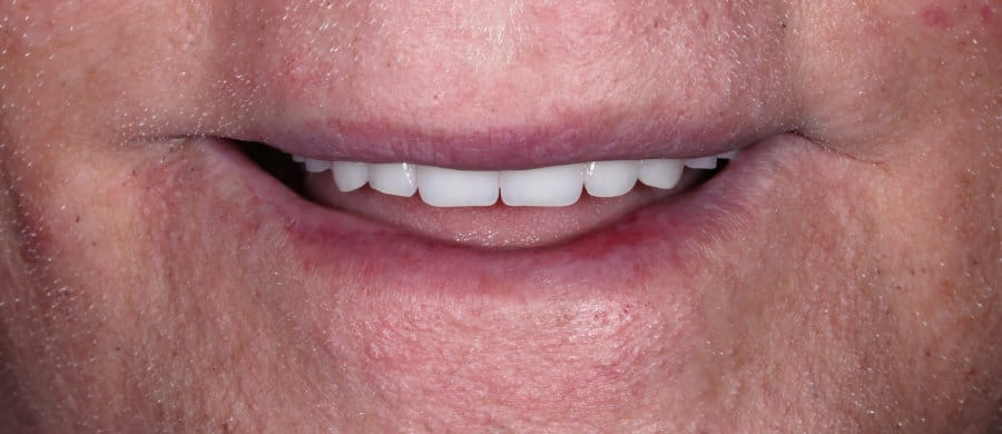 ΟΛΙΚΗ ΟΔΟΝΤΟΣΤΟΙΧΙΑ - ΜΕΤΑ