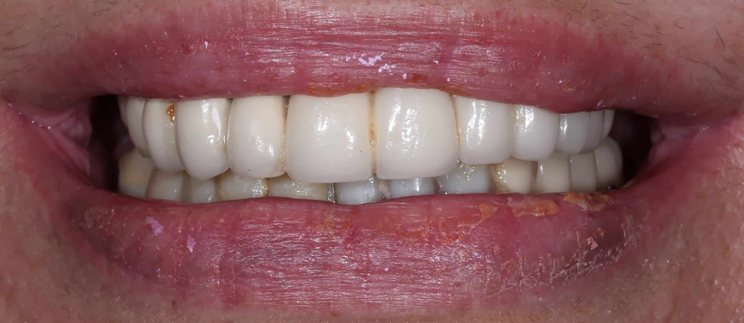 ΑΜΕΣΗ ΦΟΡΤΙΣΗ - ΠΡΙΝ