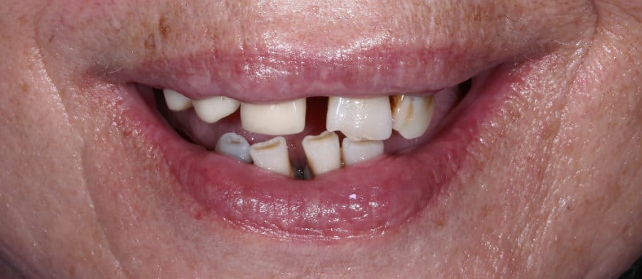 ΟΛΙΚΗ ΟΔΟΝΤΟΣΤΟΙΧΙΑ - ΠΡΙΝ