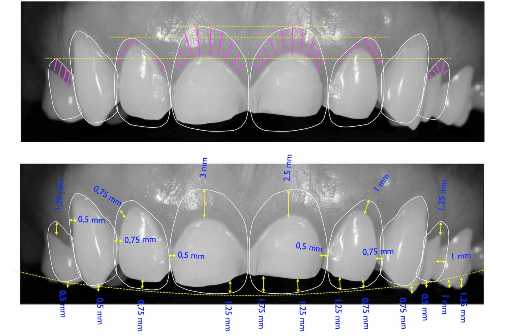 3D Σχεδιασμός Χαμόγελου: Άμεση & Ακριβής Αποτύπωση των Δοντιών σας