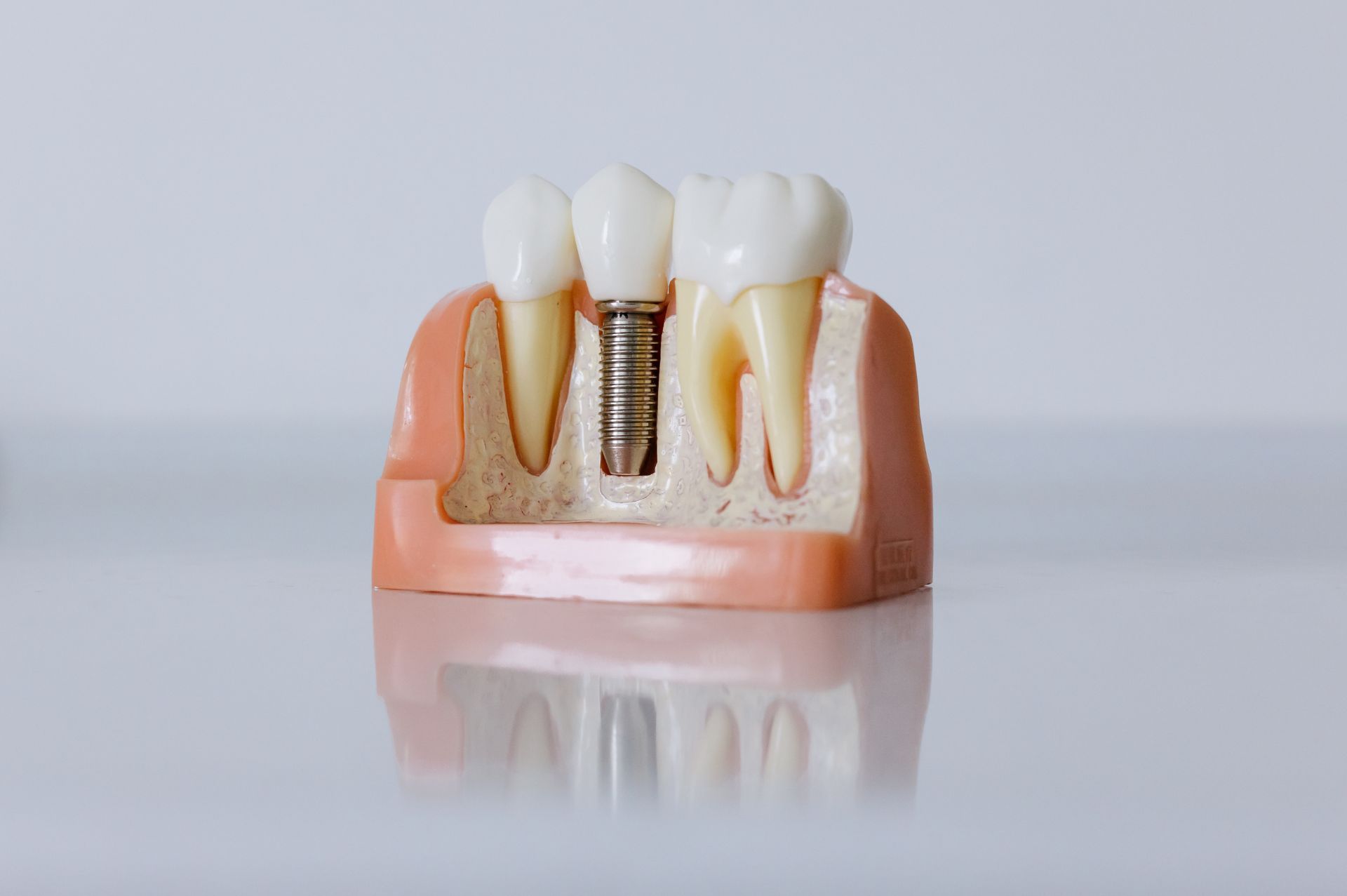 Μόσχευμα Οστού Επιπλοκές: Μία Τεχνική Χωρίς Επιπλοκές & Πόνο