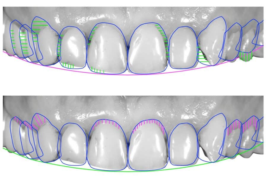 Ψηφιακό Χαμόγελο