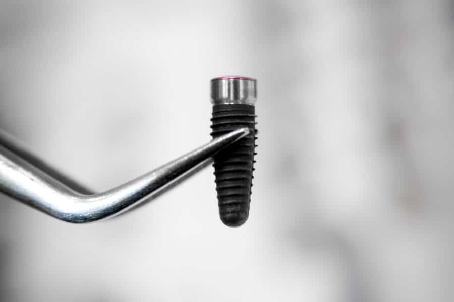 αποτυχία εμφυτευμάτων δοντιών